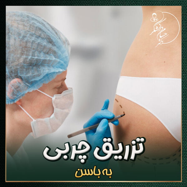 تزریق چربی به باسن