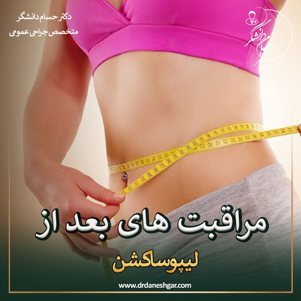 مراقبت های بعد از لیپوساکشن - دکتر سید حسام دانشگر
