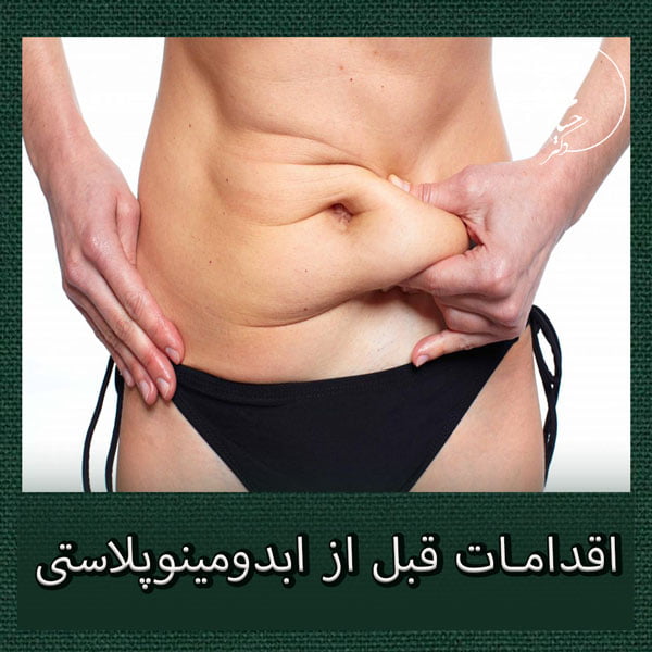 اقدامات قبل از ابدومینوپلاستی - دکتر حسام دانشگر