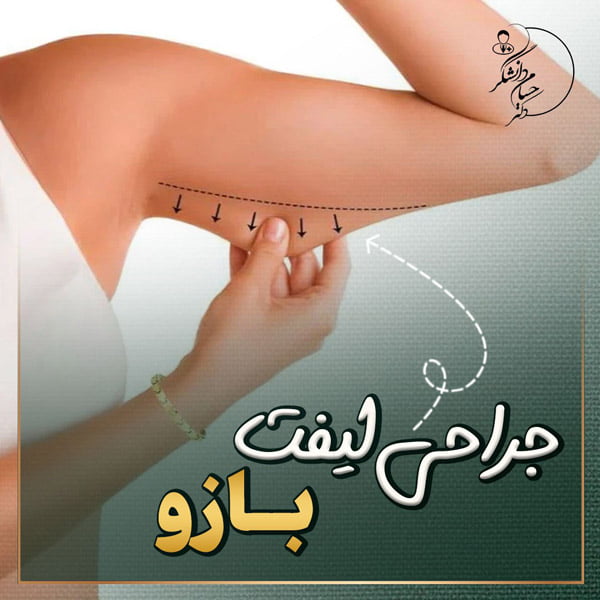 جراحی لیفت بازو - دکتر حسام دانشگر