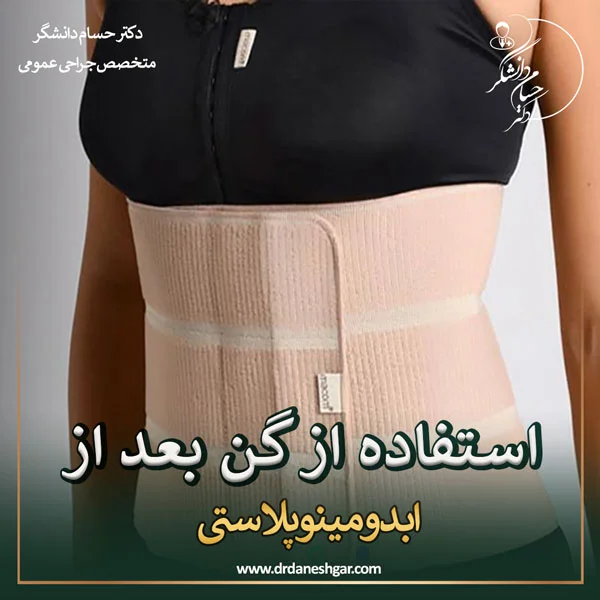 گن ابدومینوپلاستی - دکتر سید حسام دانشگر