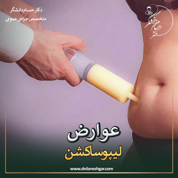 عوارض لیپوساکشن - دکتر سید حسام دانشگر