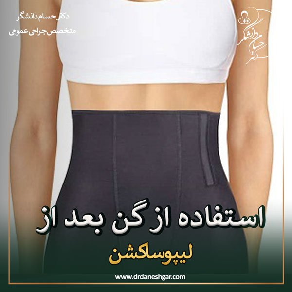 گن لیپوساشکن - دکتر سید حسام دانشگر