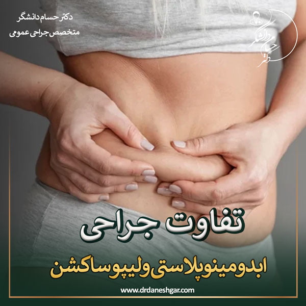 تفاوت جراحی ابدومینوپلاستی و لیپوساکشن - دکتر سید حسام دانشگر