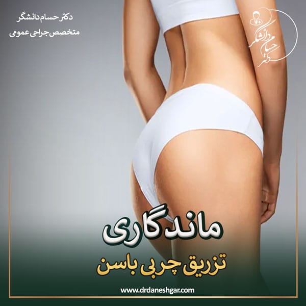 ماندگاری تزریق چربی باسن در آبادان _ دکتر سید حسام دانشگر