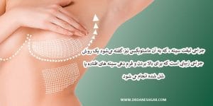 جراحی ماستوپکسی در آبادان _ دکتر سید حسام دانشگر