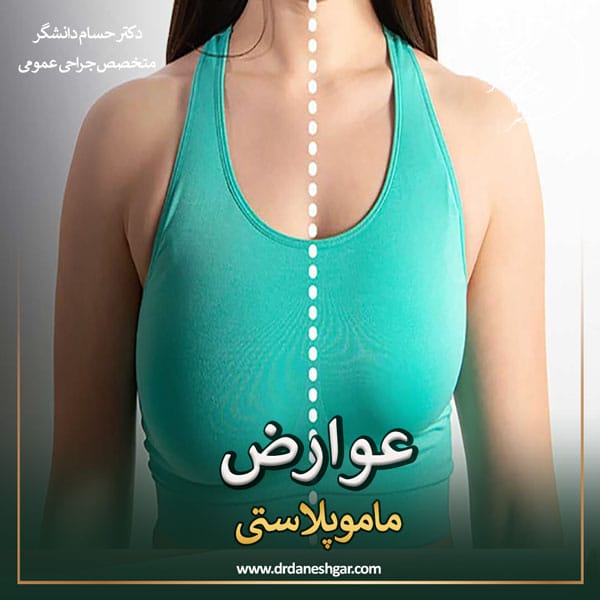 عوارض ماموپلاستی - دکتر سید حسام دانشگر