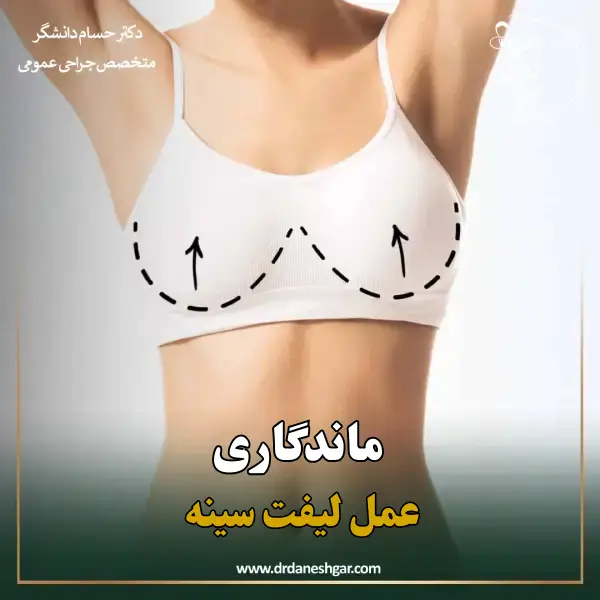 ماندگاری عمل لیفت سینه _ دکتر سید حسام دانشگر