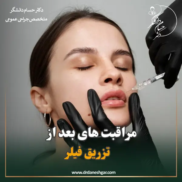مراقبت های بعد از تزریق فیلر _ دکتر سید حسام دانشگر