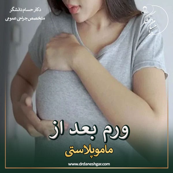 ورم بعد از جراحی ماموپلاستی _ دکتر سید حسام دانشگر