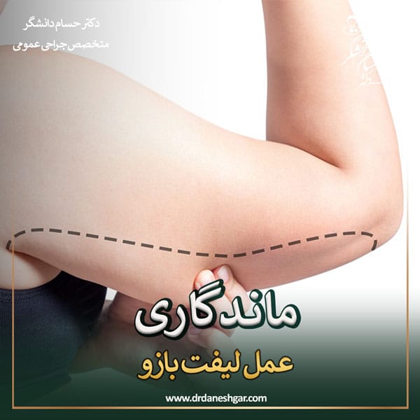 ماندگاری جراحی لیفت بازو _ دکتر سید حسام دانشگر