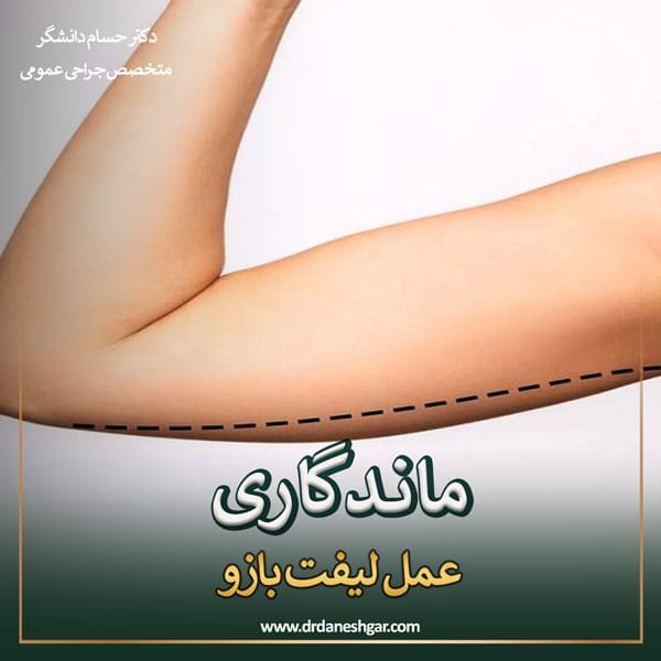 ماندگاری نتیجه عمل لیفت بازو _ دکتر سید حسام دانشگر