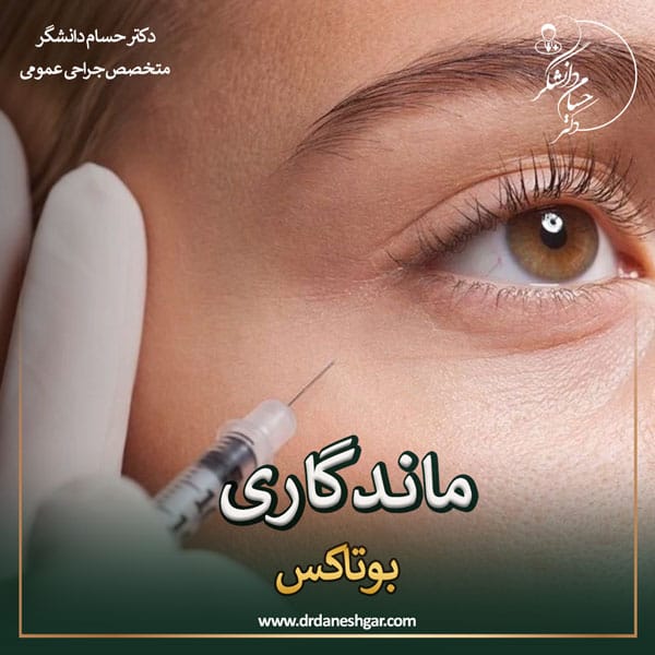 ماندگاری بوتاکس صورت _ دکتر سید حسام دانشگر