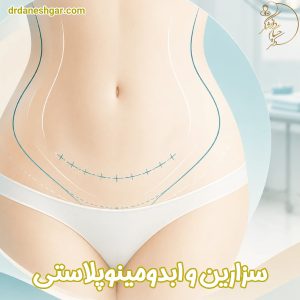 سزارین و ابدومینوپلاستی