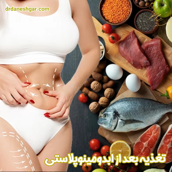 تغذیه بعد از ابدومینوپلاستی
